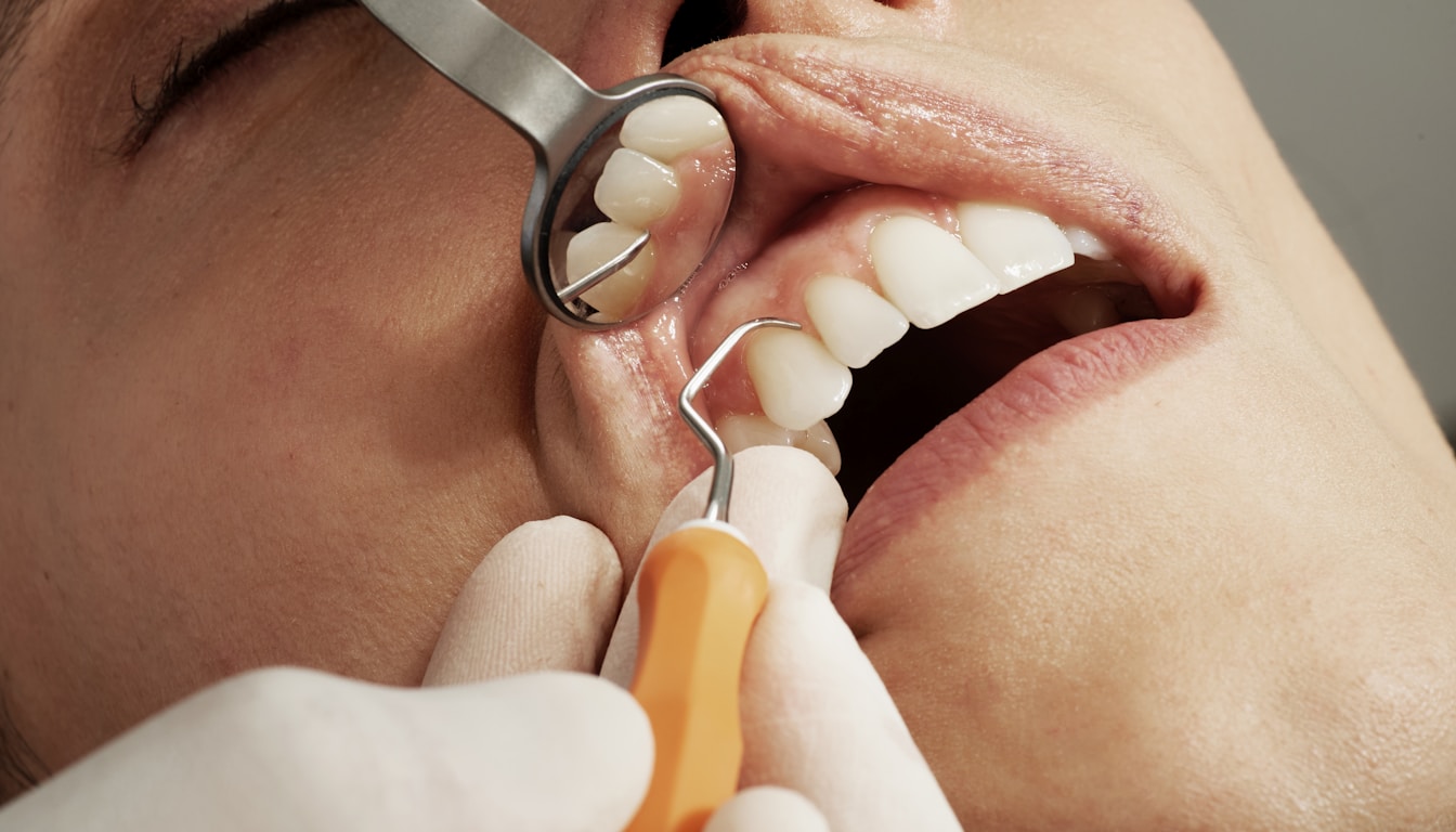 Wisdom Teeth Removal in NYC: A Complete Patient Guide